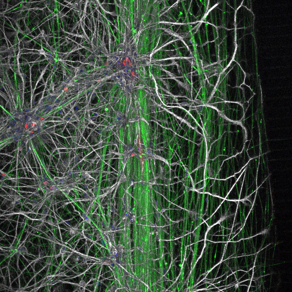 Cnr sensory device 2