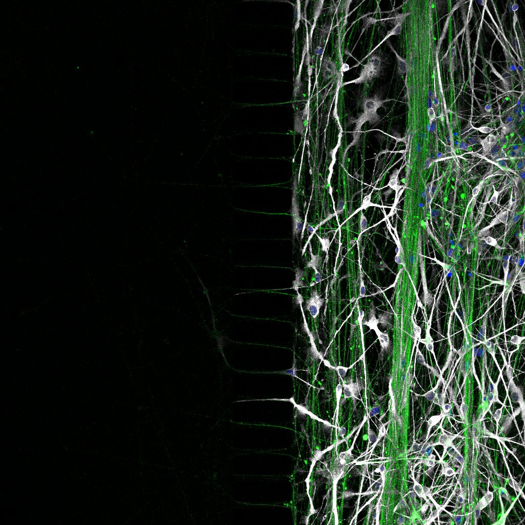 Cnr sensory device 3