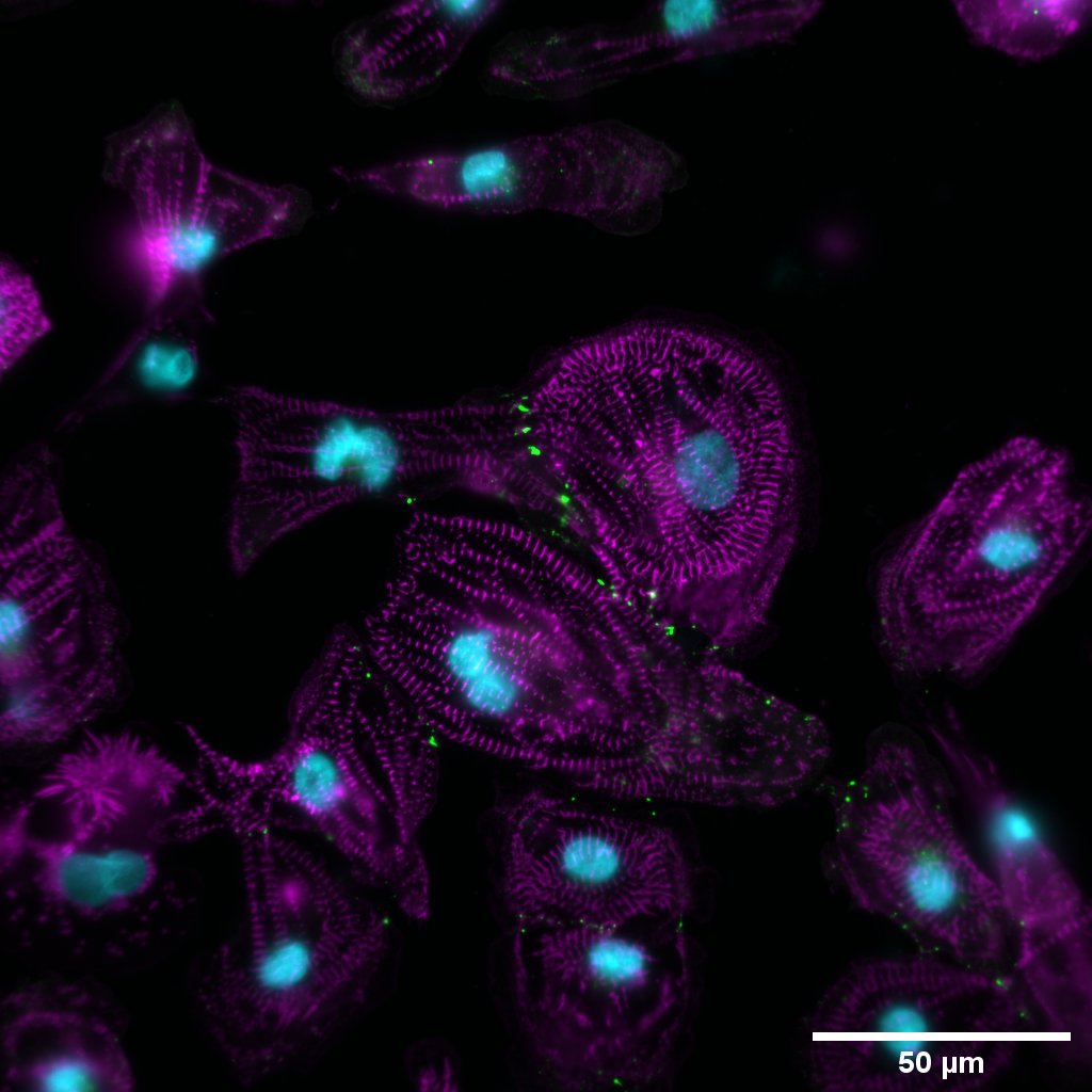 Ich 2d cardiomyocyte