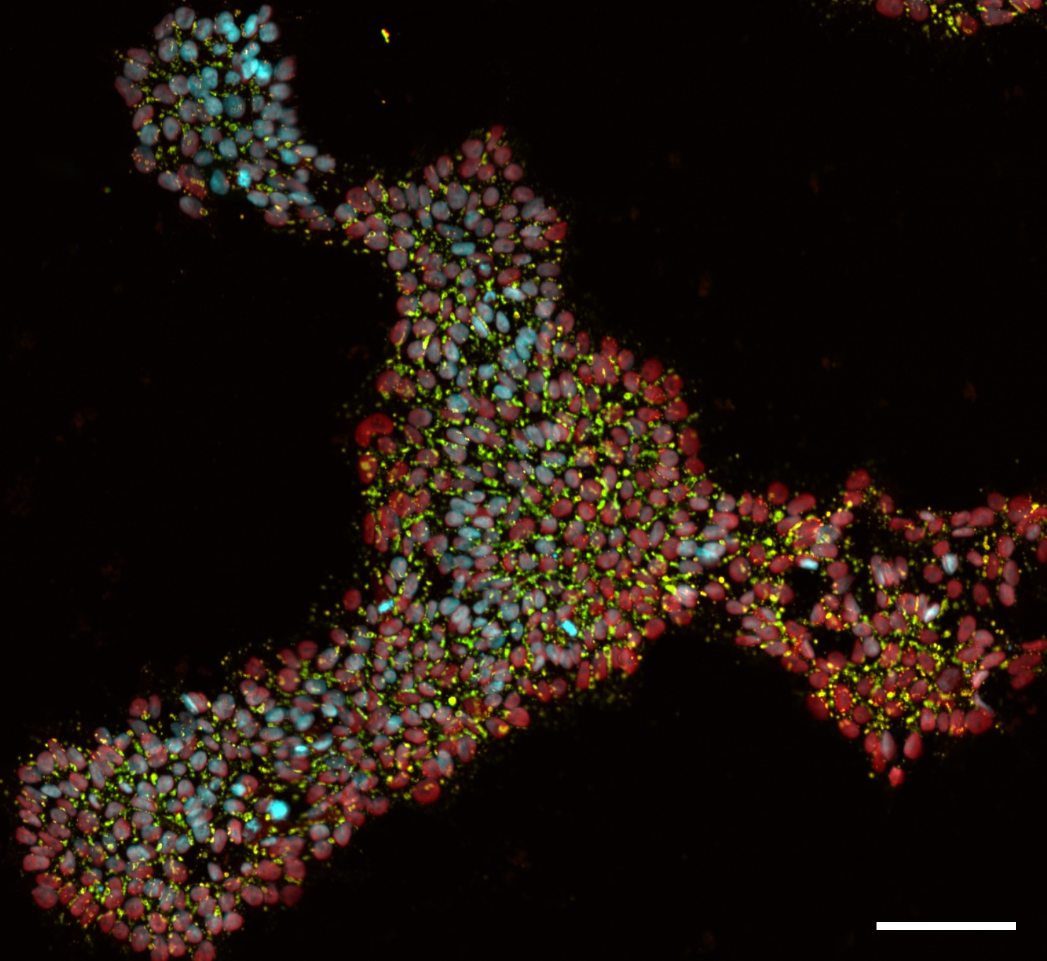 Nmi hipsc stemness ssea4