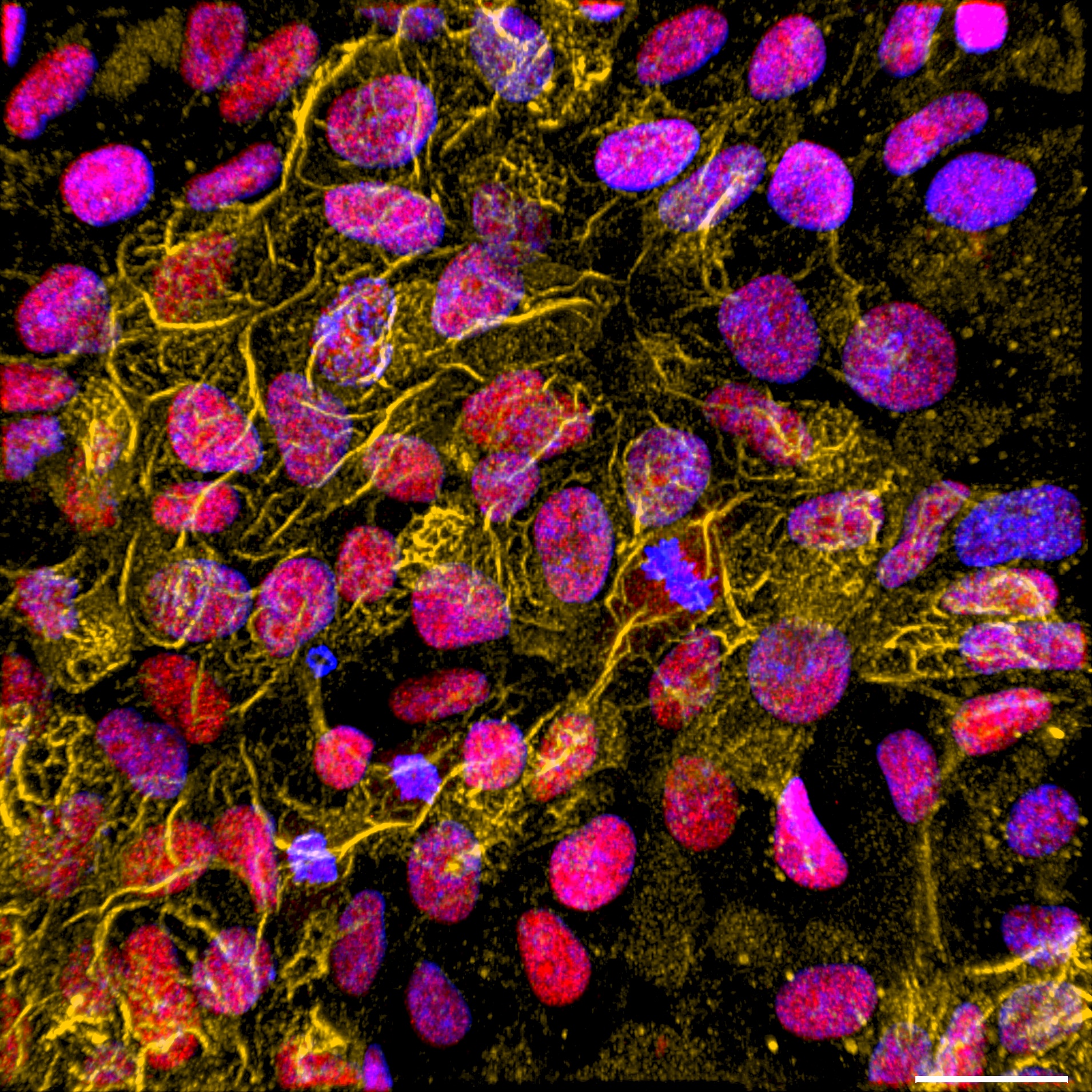 Nmi hipsc stemness tra1 60