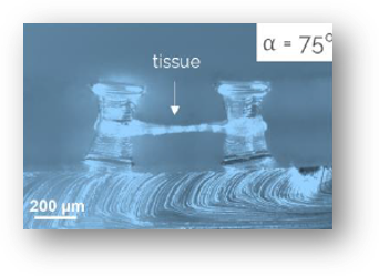 Engineered heart tissue